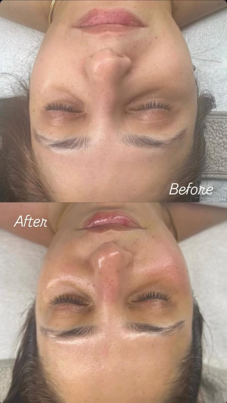 Facial before and after glow restoration treatment