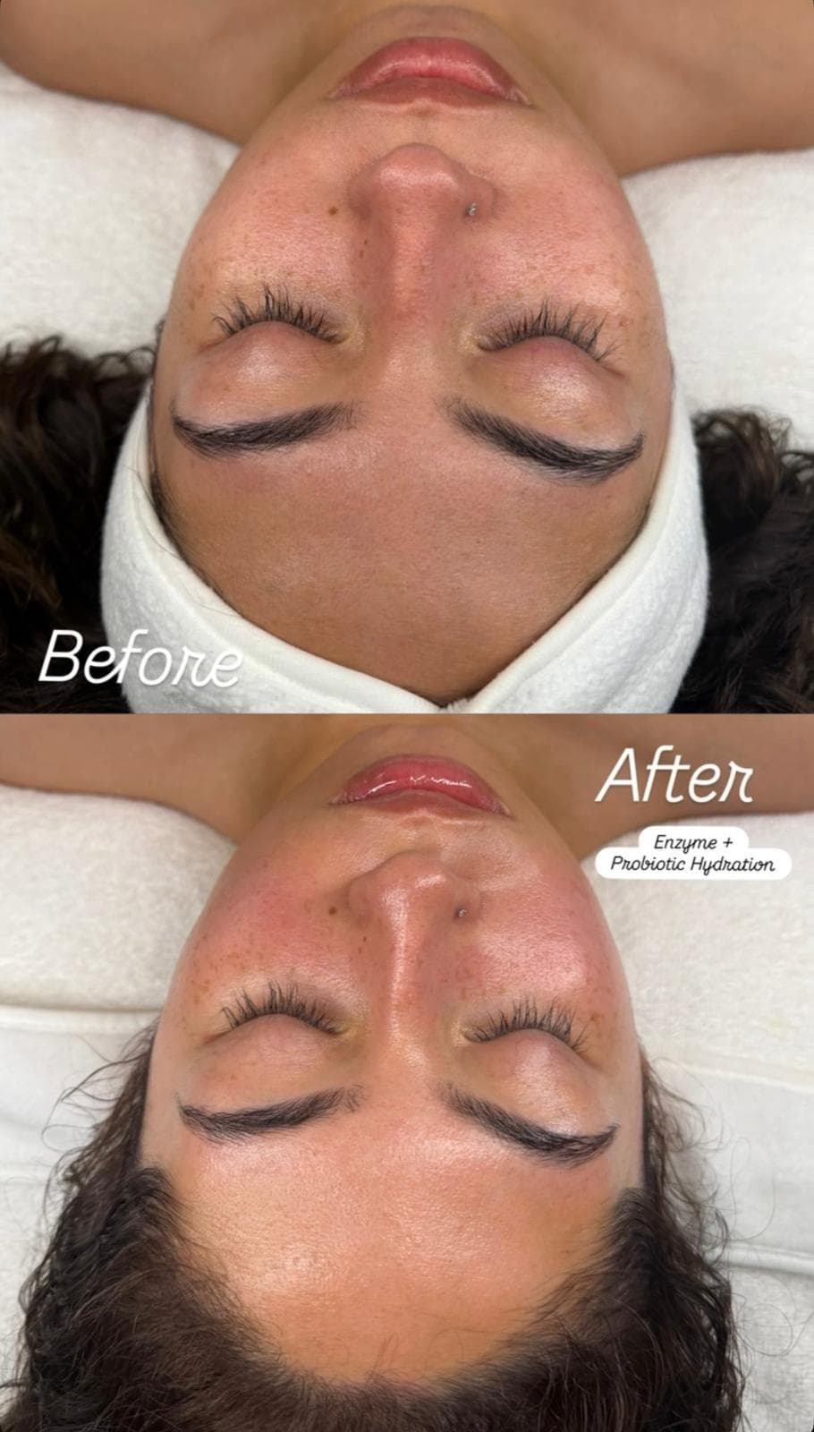 Facial before and after enzyme probiotic hydration